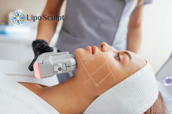 HIFU vs Botulinum Toxin: Understanding the Differences 1 HIFU vs Botox Maidstone What is the best option for you?