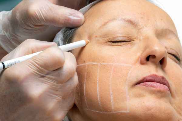 CryoPen: 5 Skin Concerns It May Be Used to Treat 4 What should you ask before having CryoPen treatment Maidstone?
